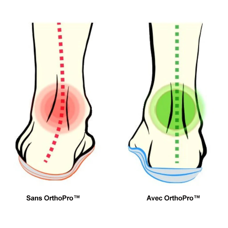 OrthoFlex™ - Semelles Orthopédiques Révolutionnaires